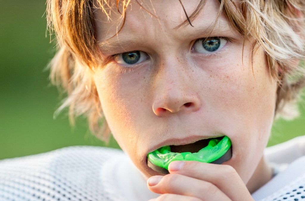 Importance of Wearing Mouthguards During Sports