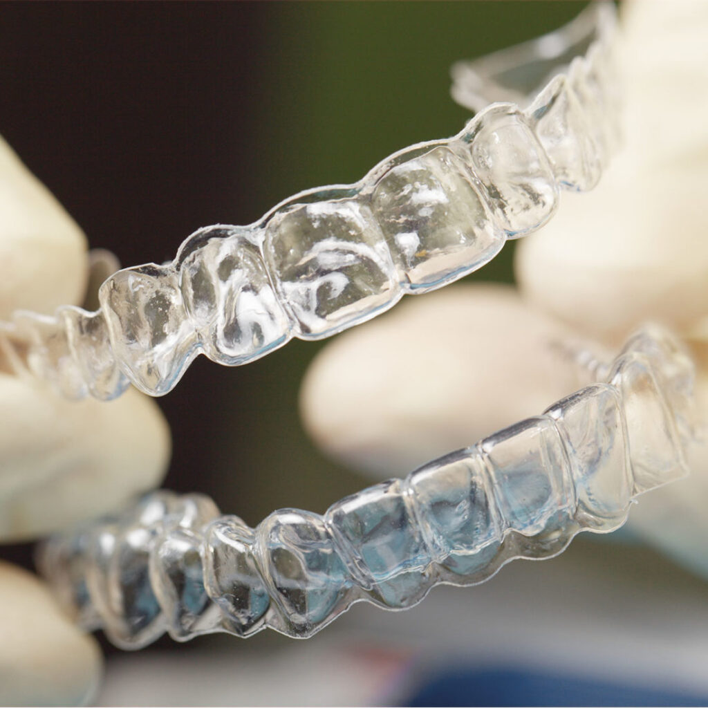 clear aligner therapy in sw calgary